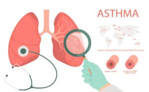 Hen suyễn là một bệnh phổi mãn tính có thể bắt đầu ở mọi lứa tuổi. Nó làm cho niêm mạc của các ống phế quản - đường dẫn khí vào phổi - trở nên đỏ, sưng và nhạy cảm.