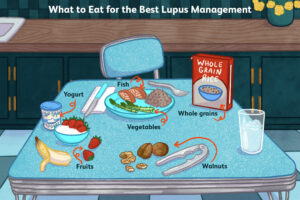 lupus management diet 48421532 a437254640da4e1d8637f25ac1a00870 | Ăn Chay, Thuần Chay, Quán Chay & Nhà Hàng Chay