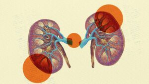 What Are the Signs of Kidney Disease GettyImages 623682045 2000 fa8800add9584317ac099dd21191cb38 | Ăn Chay, Thuần Chay, Quán Chay & Nhà Hàng Chay